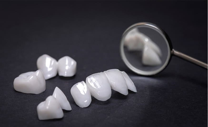 セラミック審美歯科治療