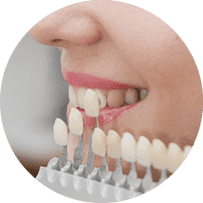 ホワイトニング